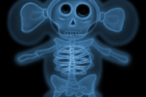 Чебурашка на ренгене (концепт-арт)