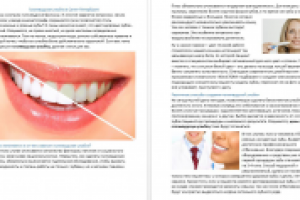 Голливудская улыбка в Санкт Петербурге