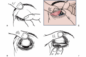 Медицинская иллюстрация для книги