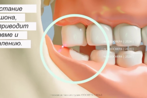Анимационный ролик