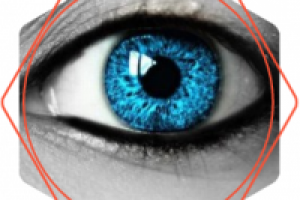 Катаракта: современное лечение в клинике