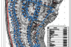 НВК поселок (Жемчужное озеро)