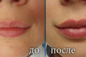 3Д татуаж губ