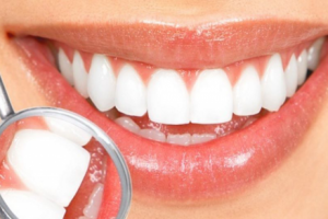 Лечение кариеса