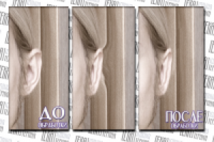 Операция на ухо