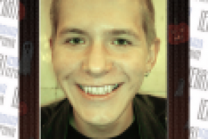 Простая стоматологическая процедура по отбеливанию и наращиванию