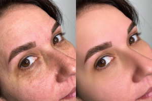 Ретушь для портфолио косметолога