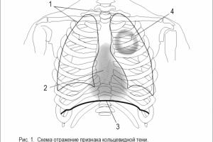 Работа 3328690