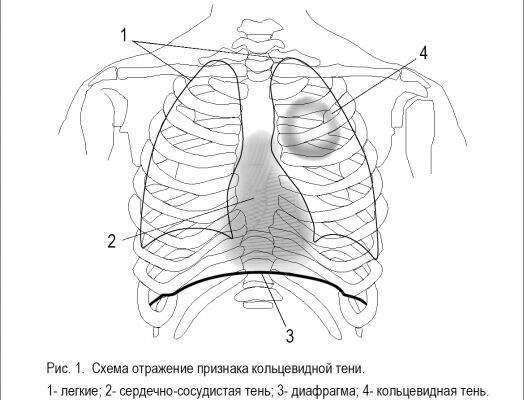 img3328690.png