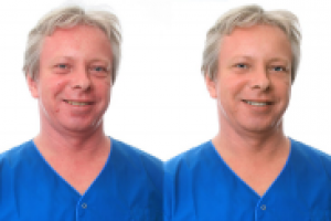 Устранение дефектов лица