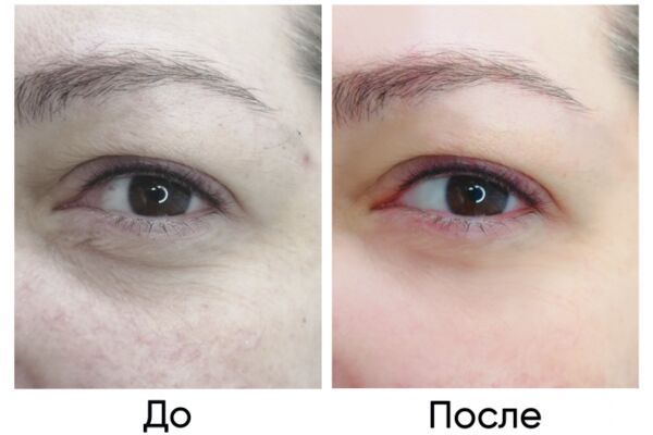 img4295494.png