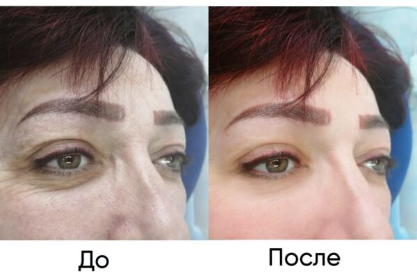 img4295493.png