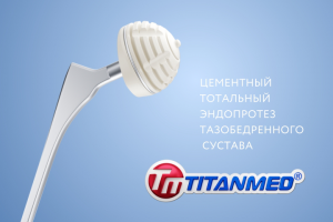Модели эндопротезов Титанмед