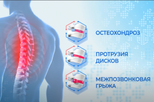 Видеореклама для Доктор Нобель