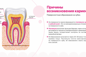 Презентация