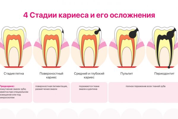 img4562451.png
