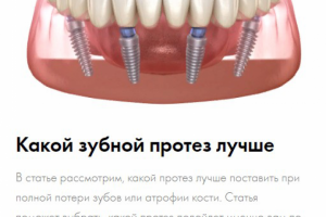 Статьи для блога на сайт YES стоматологии