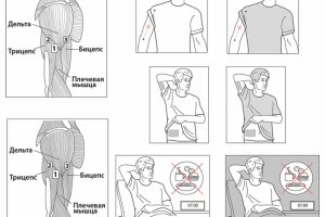 Медицинские  иллюстрации