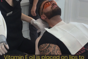 Отбеливание зубов видео для Instagram