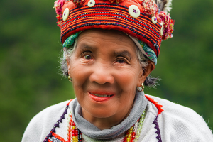 Пластика лица