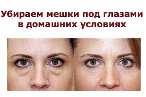 Убираем мешки под глазами, отёчность в домашних условиях