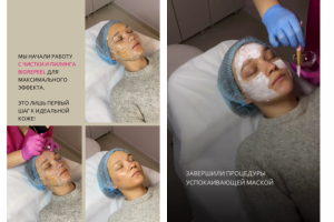 Ведение сторис для косметолога