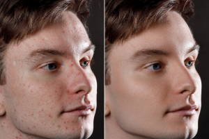 Ретушь кожи