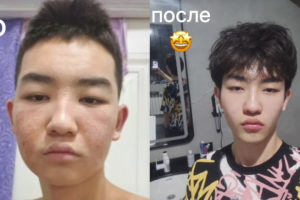 Область - Лицо, состояние кожи (безоперационно)