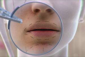 Начальная заставка для реалити-шоу "Жертвы красоты"