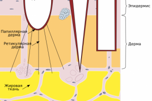Медицинская схема