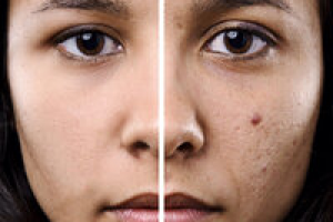 Фоторетушь