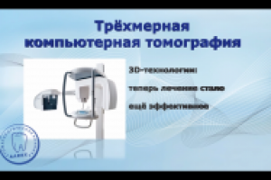 Стомалология слайд-шоу