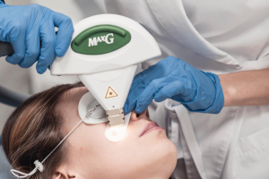 Аппарат Palomar в косметологии