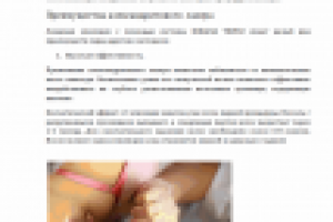 Лазерная эпиляция на аппарате IRRADIA TRIPLE