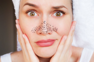 Борьба с черными точками