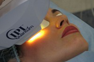 Фотоомоложение