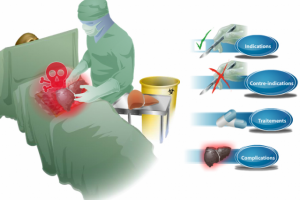 реьд5 мед извлечение