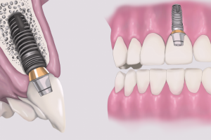 Рисунок для стоматологии