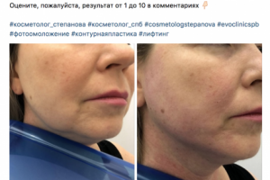 Врач-косметолог в СПб