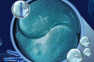 Инфографика