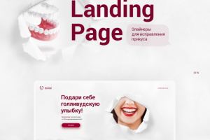 Исправление прикуса элайнерами