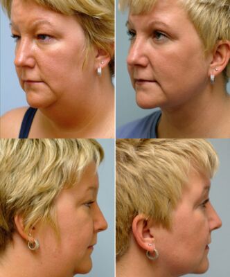 img3475470.png