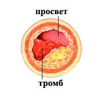 img3615733.png