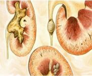 img2196341.png