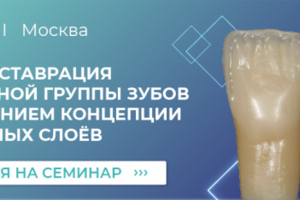 Баннер на сайт