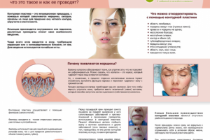 Инфо-плакаты для косметологической клиники (г. Владивосток)