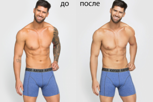 стирание татуировок