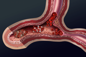 Движение крови в венах (разрез)