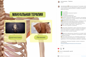 Определение мануальной терапии.