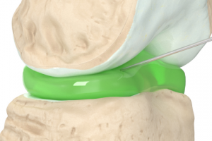 Коленный сустав